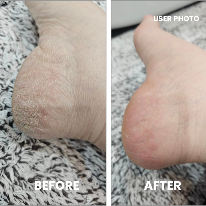 Nanocrystal foot buffer